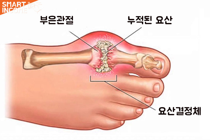 "바람만 불어도 아파요" 김종국이 운