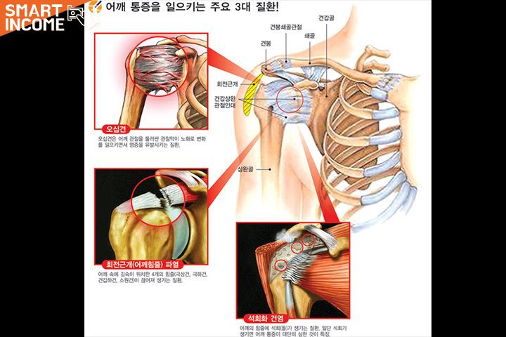 정형외과 의사가 무조건 피하라고 경고