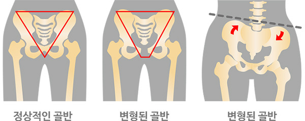 예쁜 청바지 핏을 결정하는  승마살 