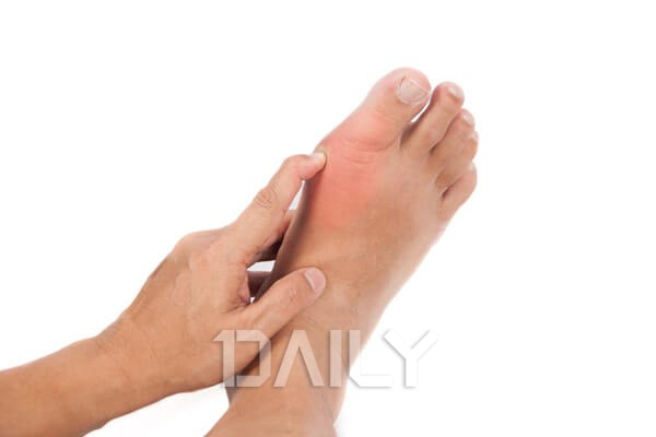 발이 붓는 이유가 갑상선 문제? 발 