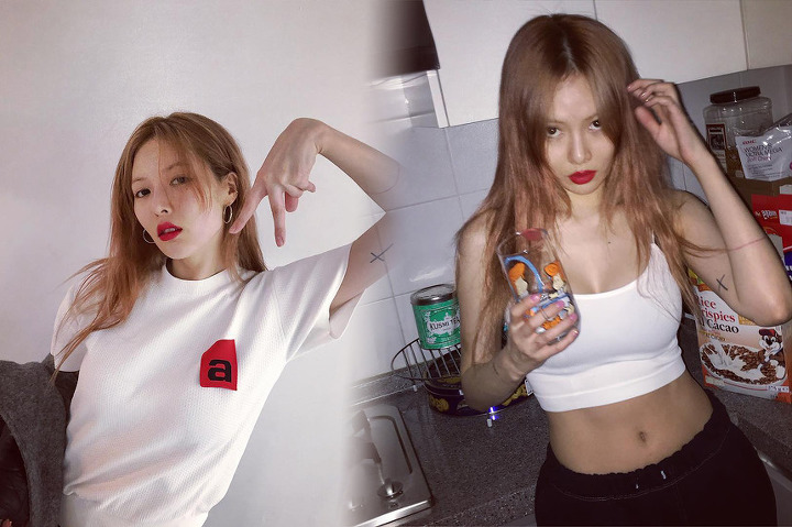 눈에 띄는 멍든 다리때문에 뜻밖의 논란중인 아이돌의 근황