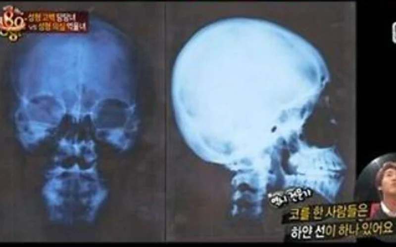 MBC ‘블라인드 테스트 180도’