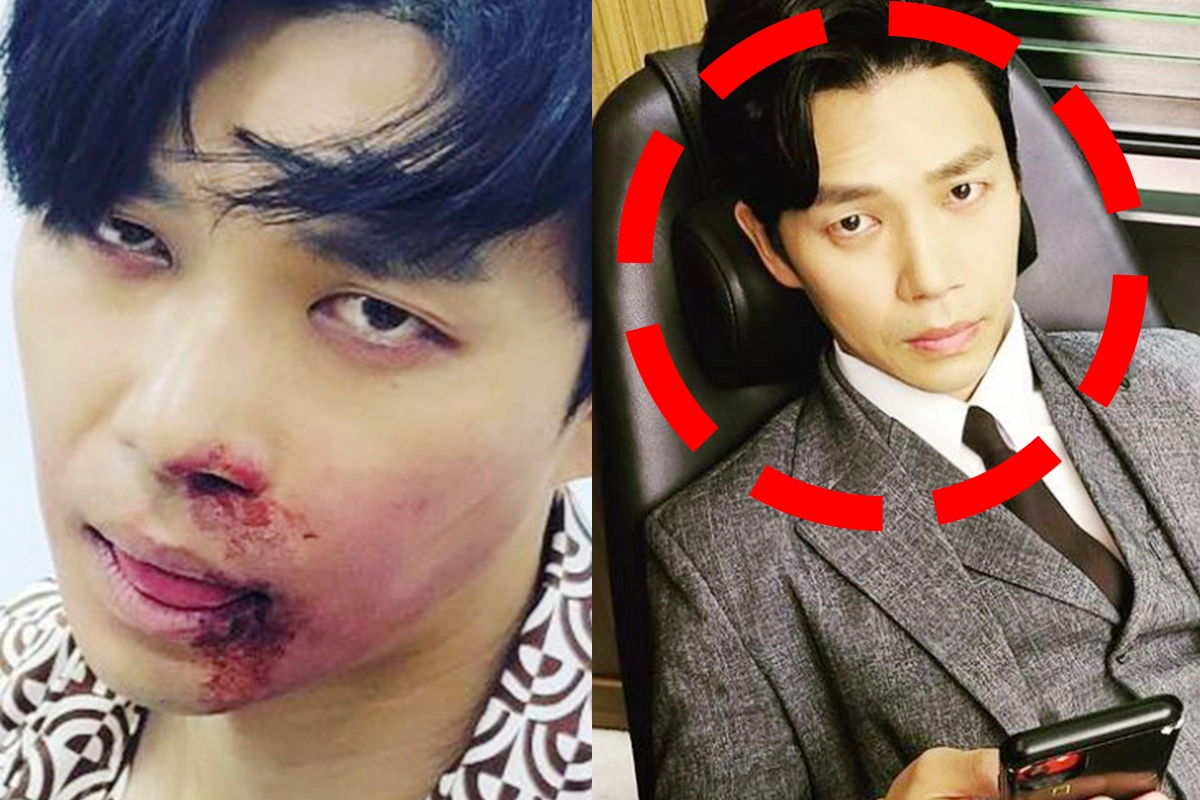 Instagram@seunghyun_1219