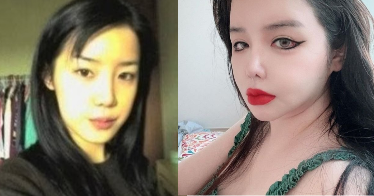 박봄 과거와 현재 얼굴 모습
