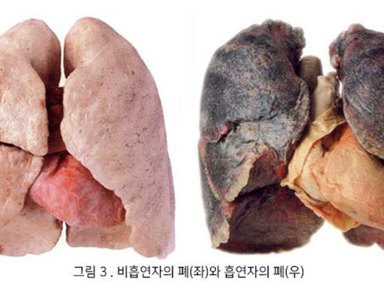 MTM전자담배 이미지